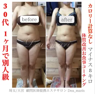 private salon Dea_maris シュガーリング&パーソナルボディケア所属・シミ改善・韓国肌管理 ボディメイク痩身のその他イメージ