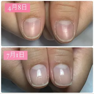 ネイル AKT NAIL所属・AKT Beauty エステヘッドスパのエステ・リラクイメージ