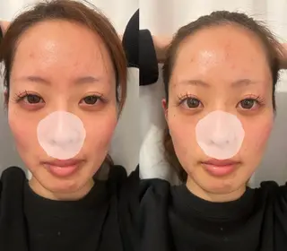 美容鍼灸サロン mahoroba院長のエステ・リラクイメージ