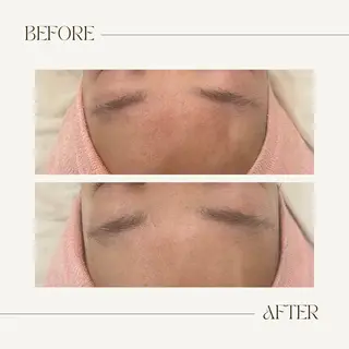 CEsalonEgg 齋藤のエステ・リラクイメージ