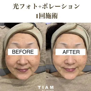 美肌サロンTIAM by tetoteのエステ・リラクイメージ