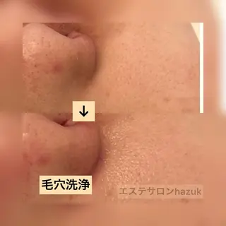 たるみ改善小顔エステ 堀葉月のその他イメージ