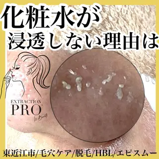 epismoo 脱毛/HBL/毛穴の眉毛・アイブロウイメージ