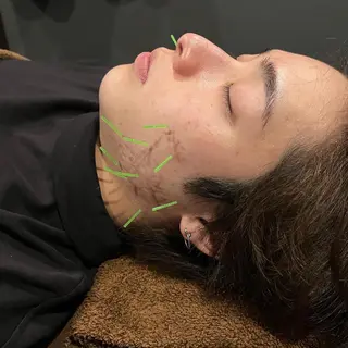 メンズ 美容鍼灸サロン LOMIHARIのエステ・リラクイメージ