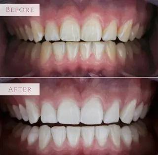 ecxia新宿西口店所属・セルフホワイトニング エクシア新宿西口店のその他イメージ