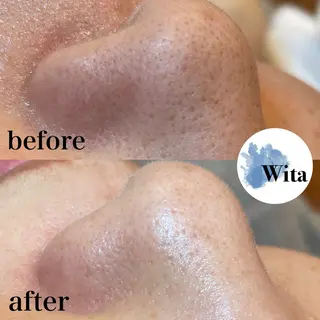 Wita   aesthetic×eyelash所属・上坂 祐以のエステ・リラクイメージ