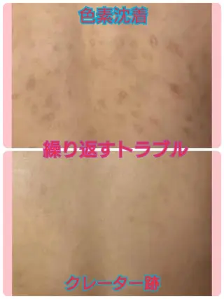 ハーブピーリング 専門店Kikkaのエステ・リラクイメージ