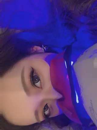 鍼灸整骨院Refine所属・鍼灸 Refineのその他イメージ