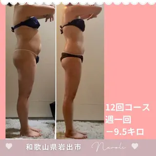 温活beautyサロンNeroli所属・切らない脂肪吸引🔥 Neroliまりこのエステ・リラクイメージ