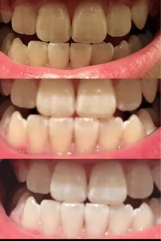 salon cohanaのマツエク・マツパデザイン