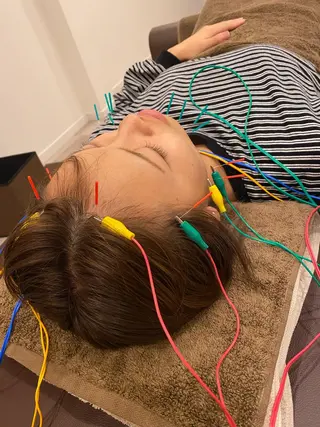 美容鍼灸Solana所属・肌質改善×美容鍼 ゆいのエステ・リラクイメージ