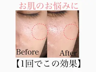 六本木脱毛andS 店長Sachiのエステ・リラクイメージ
