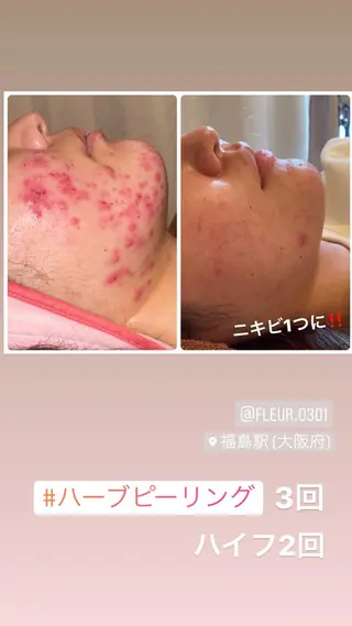 FLEUR大阪・整体 ・ハイフ・痩身・小顔のエステ・リラクイメージ