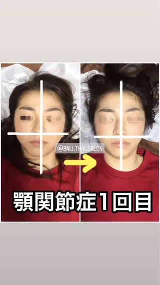 🌈歪み改善🌈 バリンタイ すぎうらのエステ・リラクイメージ