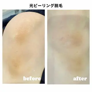 Beauty Salon Moonstone所属・Moonstone 男女•キッズ脱毛のエステ・リラクイメージ