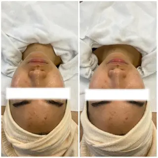 アイブロウ 肌質改善美容サロン ému 用賀のエステ・リラクイメージ