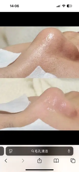 YUIITSU所属・YUIITSU 小顔コルギのエステ・リラクイメージ