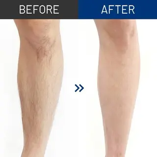 美肌脱毛専門サロン muro.のエステ・リラクイメージ