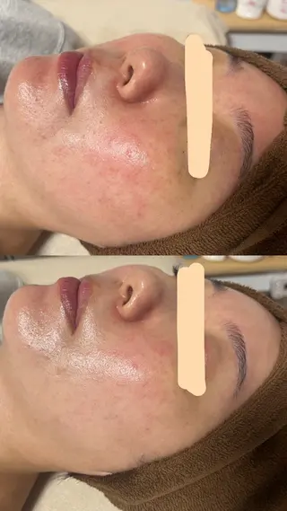 salon More所属・出口 玲菜のエステ・リラクイメージ