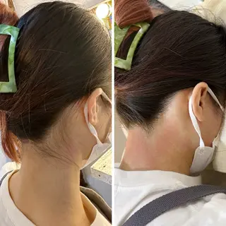 うなじ脱毛/美肌脱毛 LABELのエステ・リラクイメージ