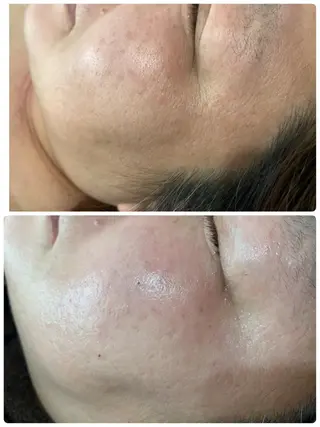 espoir エスポワールのネイルデザイン