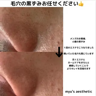 ミューズエステ 谷口美結のエステ・リラクイメージ