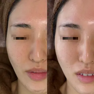 肌育×小顔×毛穴洗浄 ただののエステ・リラクイメージ