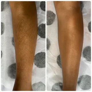 yellow.所属・yellow💛【 脱毛&フェイシャル】のエステ・リラクイメージ