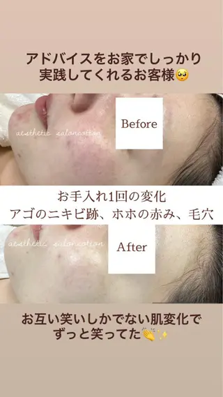 都度払い 肌質改善専門サロンのエステ・リラクイメージ