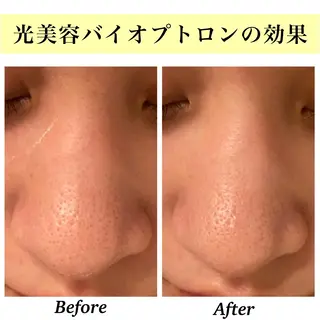 Bellesthe (ベルエステ)のエステ・リラクイメージ