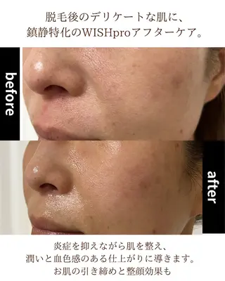 Total Beauty salon Bloom所属・肌育WISHpro 専門サロンBloomのエステ・リラクイメージ