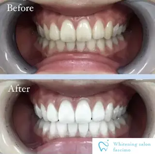 セルフホワイトニングサロンfascimo所属・ホワイトニングサロン fascimo新座店のその他イメージ