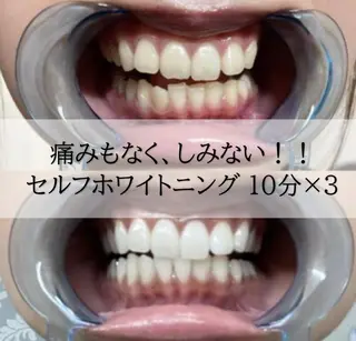 ホワイトニング専門店 LCS 銀座店 峰岡のその他イメージ