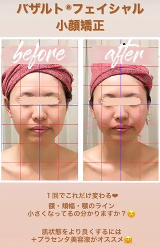 糸島 エステサロンmiuのエステ・リラクイメージ