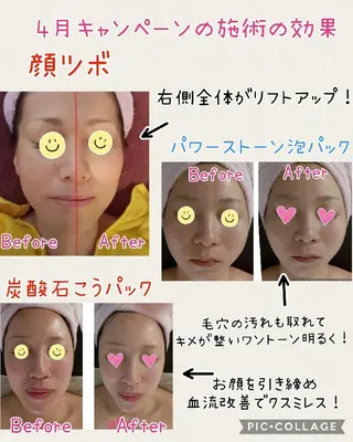 beauty salon    向日葵所属・beauty  salon 向日葵のエステ・リラクイメージ