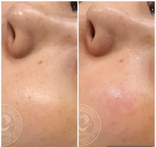 Lavi&所属・肌質改善サロン Lavi&のその他イメージ