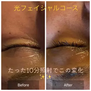 Mandarin Orange所属・毛穴から始める肌メン テマンダリンオレンジのエステ・リラクイメージ