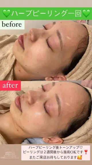 Salon de Lino 御器所のエステ・リラクイメージ