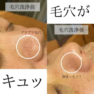 ハーブピーリング・毛穴ケア専門サロンSalon de LENA所属・ハーブピーリング 専門店/名古屋駅前店のエステ・リラクイメージ