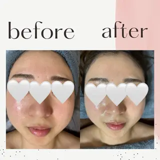 ESTHETIC SALON milulu所属・大栁 晶子のエステ・リラクイメージ