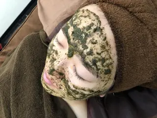 美容鍼灸整体サロンBeauJu所属・小顔矯/美容鍼/鍼灸 BeauJuのその他イメージ