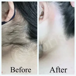 川越ローマピンク 光脱毛＆ワックス脱毛のエステ・リラクイメージ