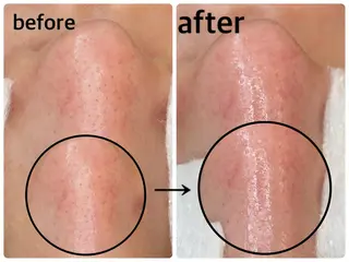 韓国肌管理 【毛穴専科】のエステ・リラクイメージ