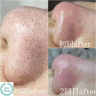 枝廣 貴子のエステ・リラクイメージ