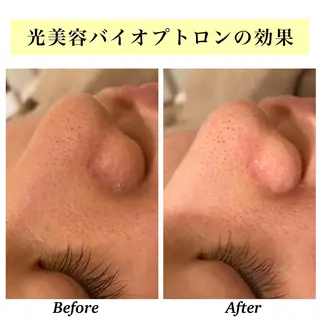 Bellesthe (ベルエステ)のエステ・リラクイメージ