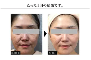 Ganesa Fusion Studio所属・井上 みあのエステ・リラクイメージ