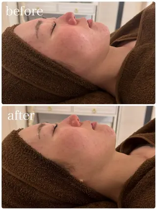 23beauty所属・武藤 那月のエステ・リラクイメージ