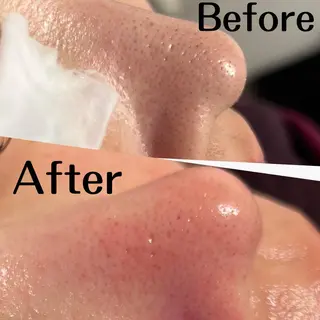 脱毛 &relaxation　M.EMINY所属・大分賀来リラクサロン M.EMINYのエステ・リラクイメージ