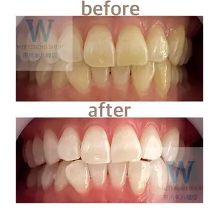 ホワイトニング ショップ本八幡店のエステ・リラクイメージ