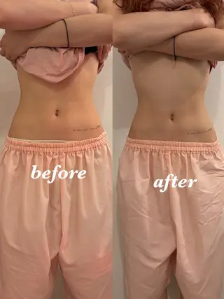 腸活サポート みなみののエステ・リラクイメージ